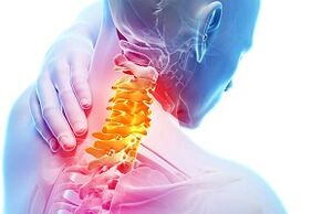 Symptoms of cervical osteochondrosing and nutrition rules for the disease