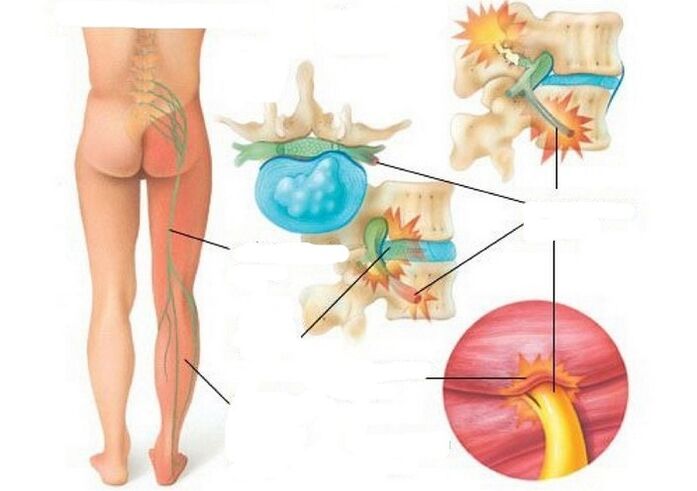 Types and reasons for pain