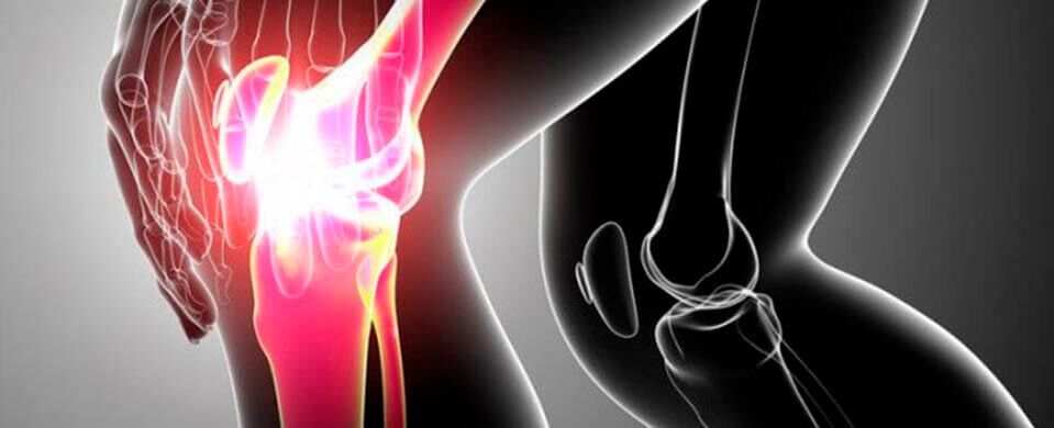 pain in the knee joint picture 4